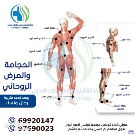 لعمل الحجامة ولسع النحل والعلاج الطبيعي